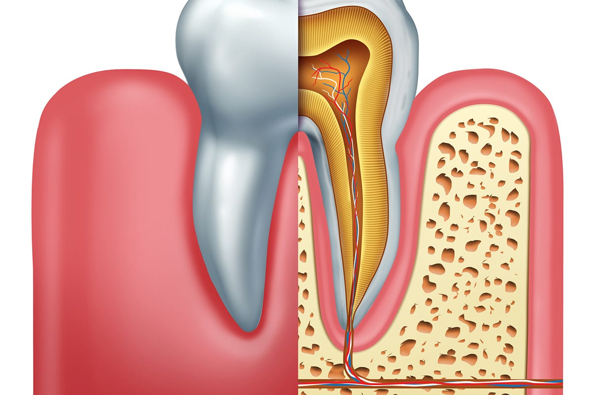 Why Do I Need a Splint? | Forest Lake Endodontics
