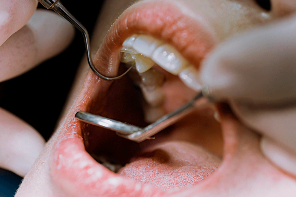 When Does A Tooth Need Endodontic Retreatment?